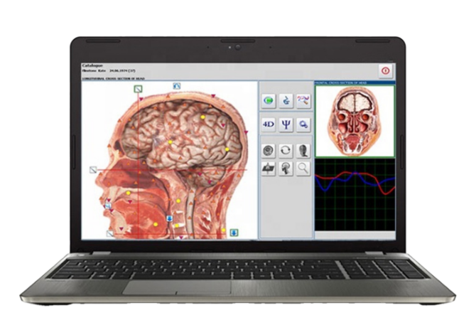 HTB1T682bsrrK1RjSspaq6AREXXax__50801