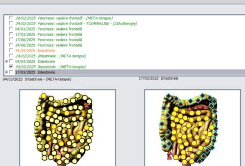 colonul inainte si dupa terapie