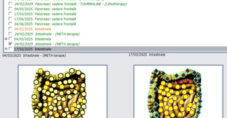 colonul inainte si dupa terapie